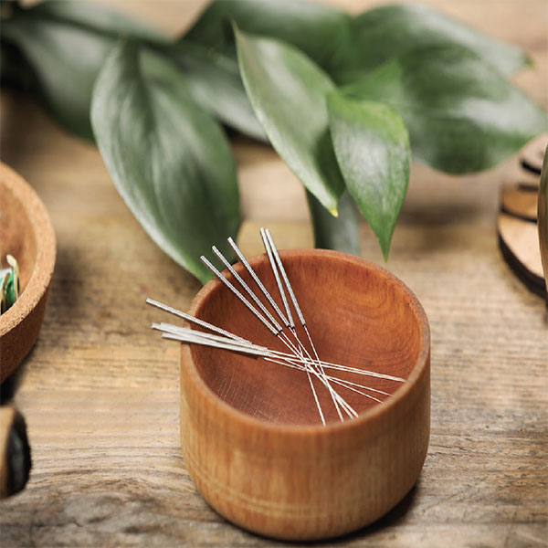 Acupuncture Service
